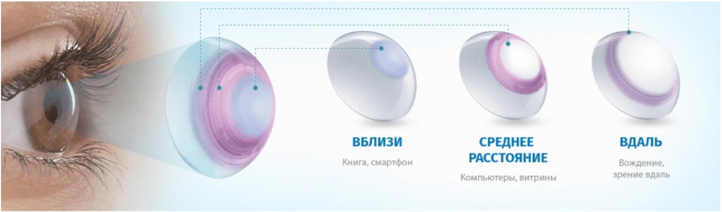 Схема зон мультифокальной контактной линзы